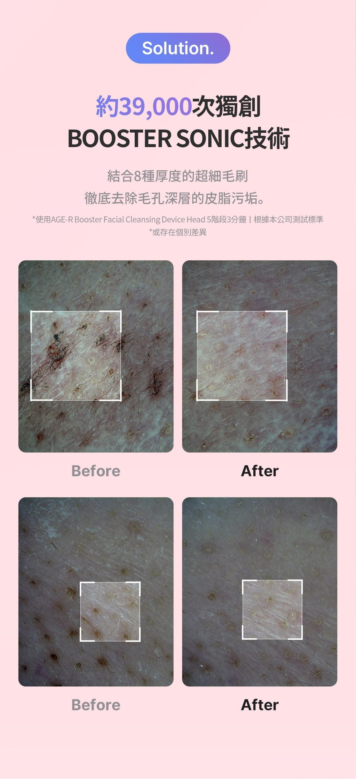 Medicube AGE-R Booster Cleanser Head - product details
