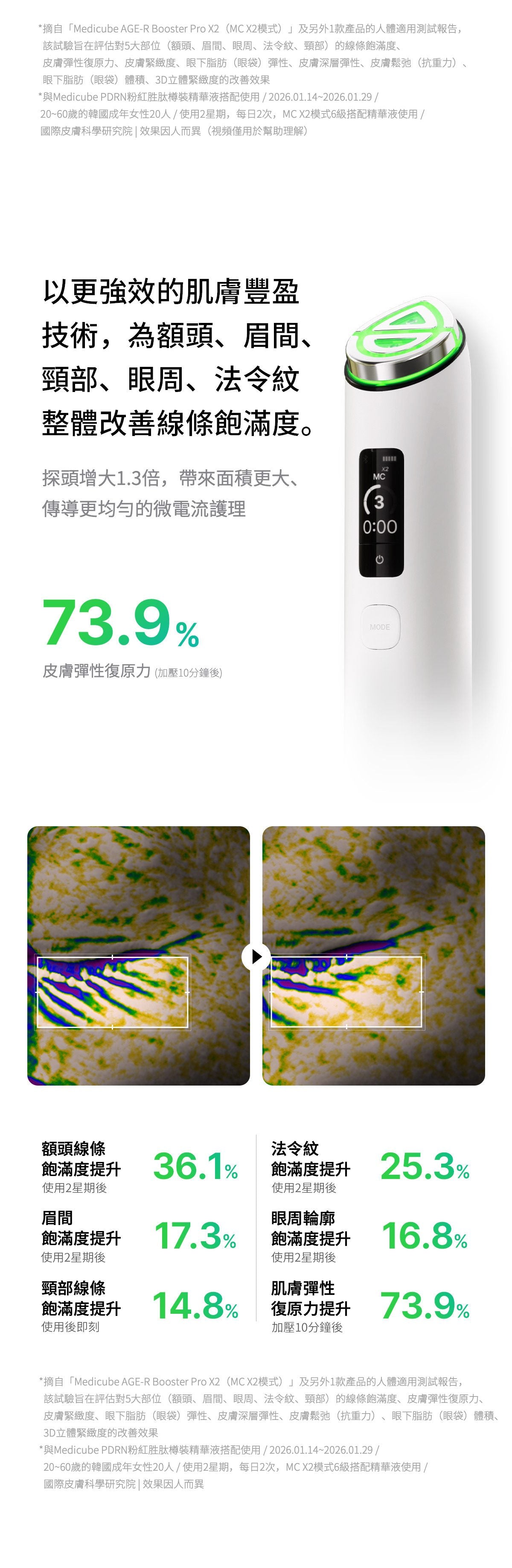 Medicube AGE-R Booster Pro X2 - product details
